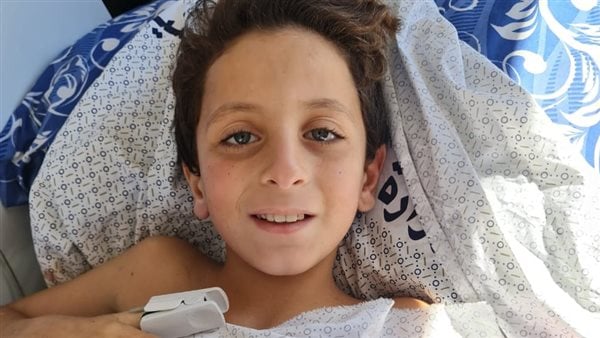 الصحة : الطفل الفلسطيني يحتاج 3 تخصصات طبية لمنع قدمه من البتر