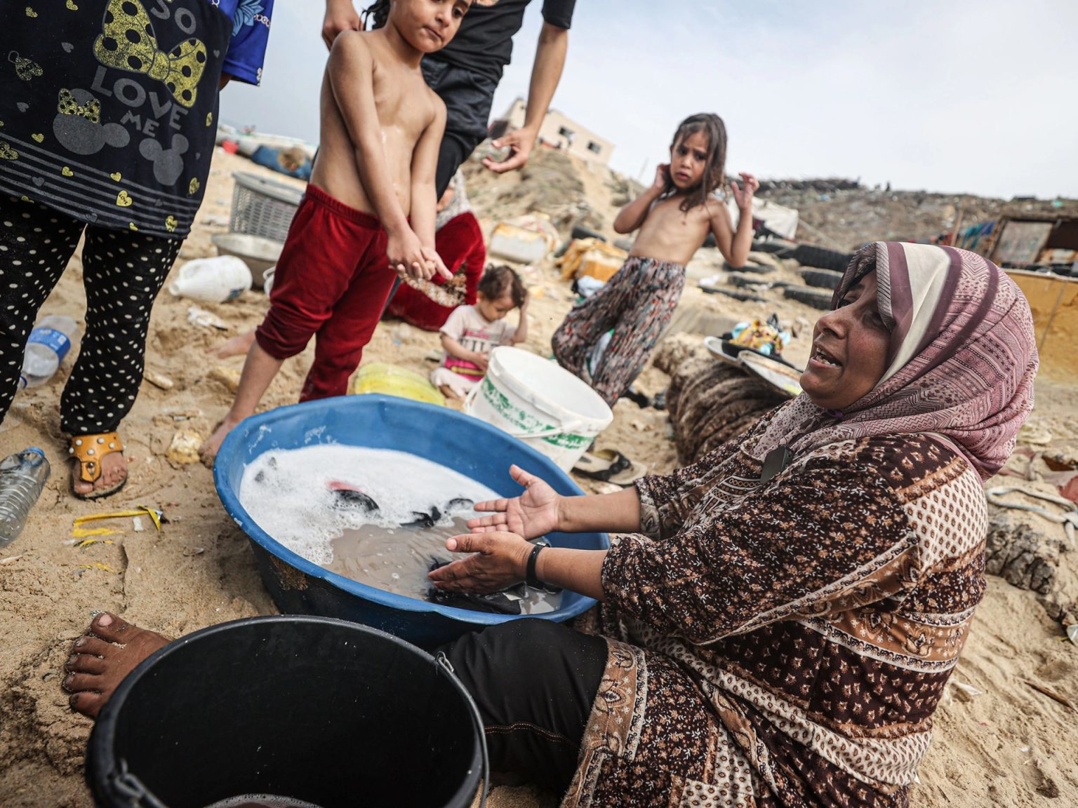 مأساة إنسانية تتفاقم.. الحرب والمجاعة والأوبئة تجتمع على غزة