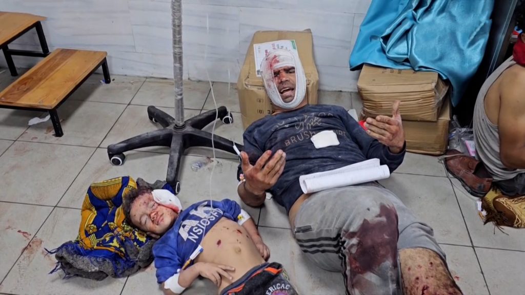 وصول الشهداء والجرحى لمستشفى كمال عدوان بعد ارتكاب الاحتلال مجزرتي الفاخورة وتل الزعتر