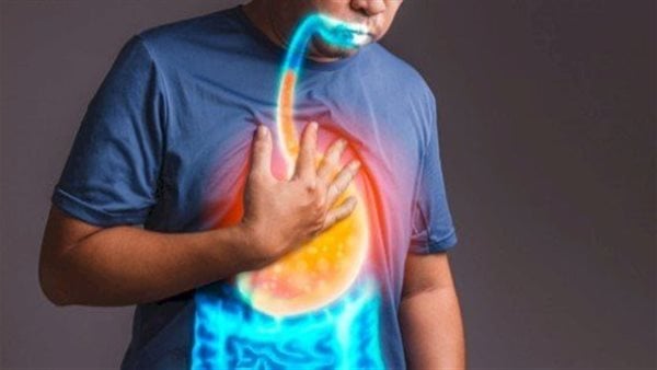 احترس منها.. أسباب دوالي المريء