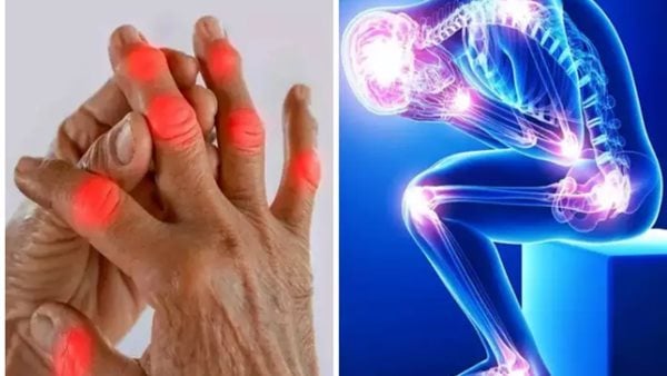 اكتشاف دواء جديد لعلاج آلام المفاصل المزمنة