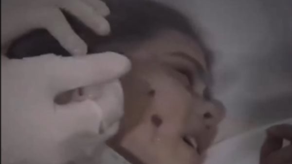 حلم ولا حقيقة؟..طفلة فلسطينية أصيبت بالقصف لا تصدق ما شاهدته| فيديو