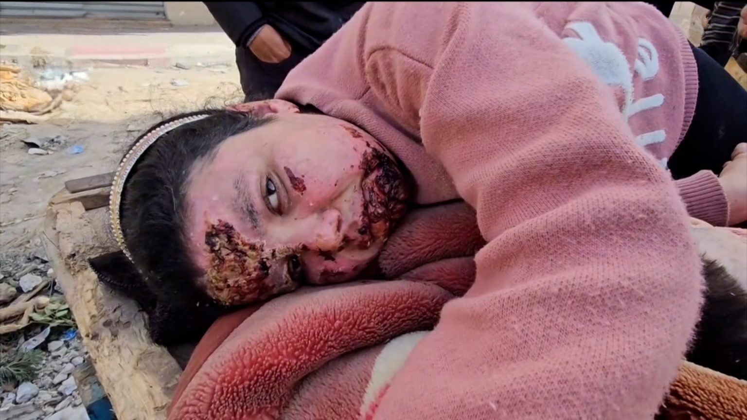 مطالبات بتحقيق دولي في دفن إسرائيل أحياء بساحة مستشفى بغزة