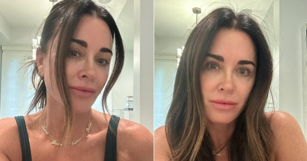 “RHOBH” النجم كايل ريتشاردز يتاجر في رذاذ التسمير لمرطب الدباغة بقيمة 10 دولارات