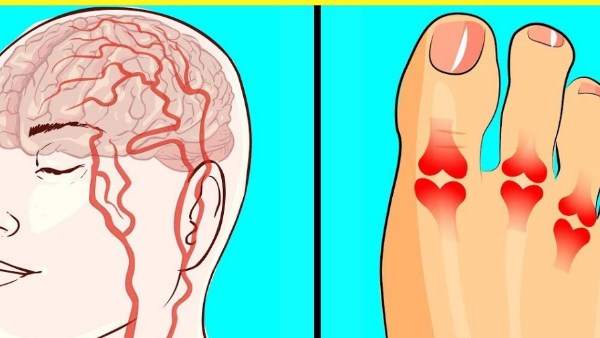 أعراض نقص فيتامين د 