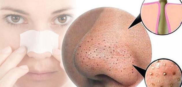سكراب البرتقال للتخلص من الرؤوس السوداء