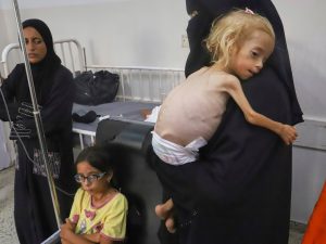 وفاة شابة من غزة جوعا بعدما وصلت إلى مستشفى في إيطاليا