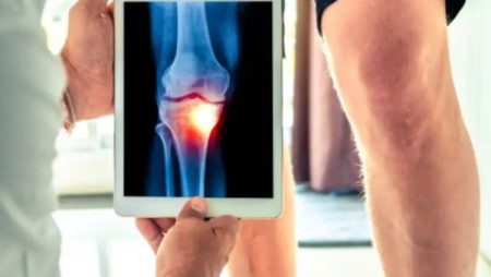 3 طرق بسيطة وطبيعية لتخفيف آلام الركبة والتهاب المفاصل.. فما هما؟