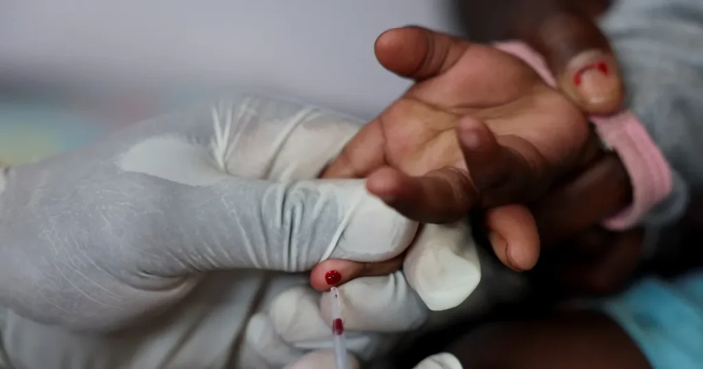 دراسة: تحليل دم جديد يتنبأ بدقة أكبر بتطور أمراض الكلى